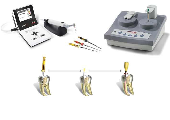 この2つの機材によってより無菌的により安全により正確な根っこの治療を行うことができます。